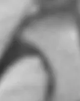 Steel